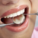 Jak się przygotować do wszczepienia implantów zębów?